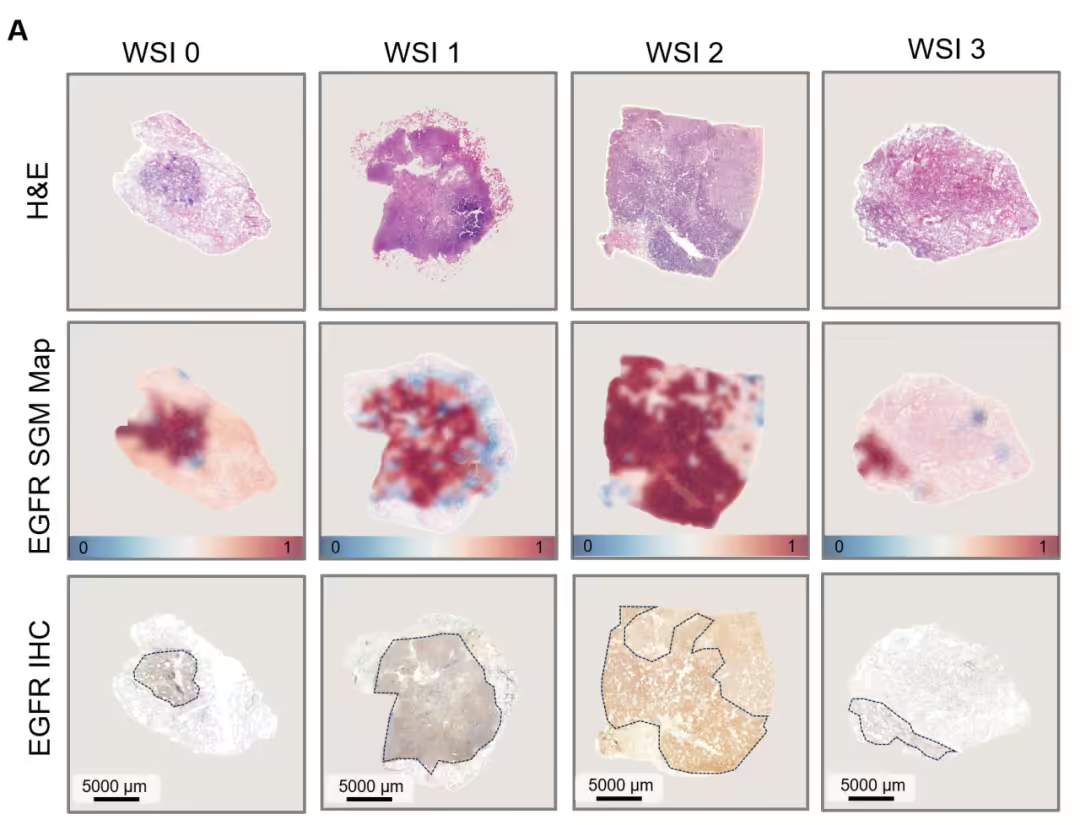 腾讯 AI 实现肺癌基因突变预测，精度最高 99%