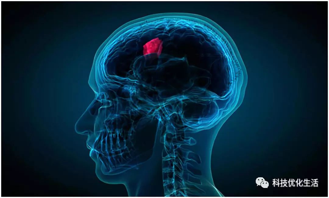 人工智能之AI如何改变癌症治疗 人工智能之AI如何改变癌症治疗