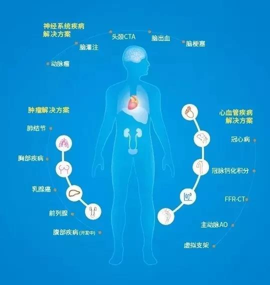 心脑血管疾病被两会重点关注，谈谈AI能帮点儿什么？