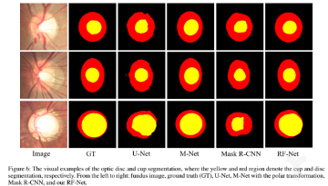 平安的AI医疗战事：如何在2年内拿下上万家医疗机构？