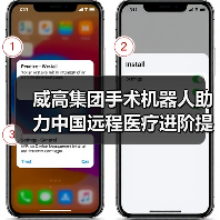 威高集团手术机器人助力中国远程医疗进阶提速